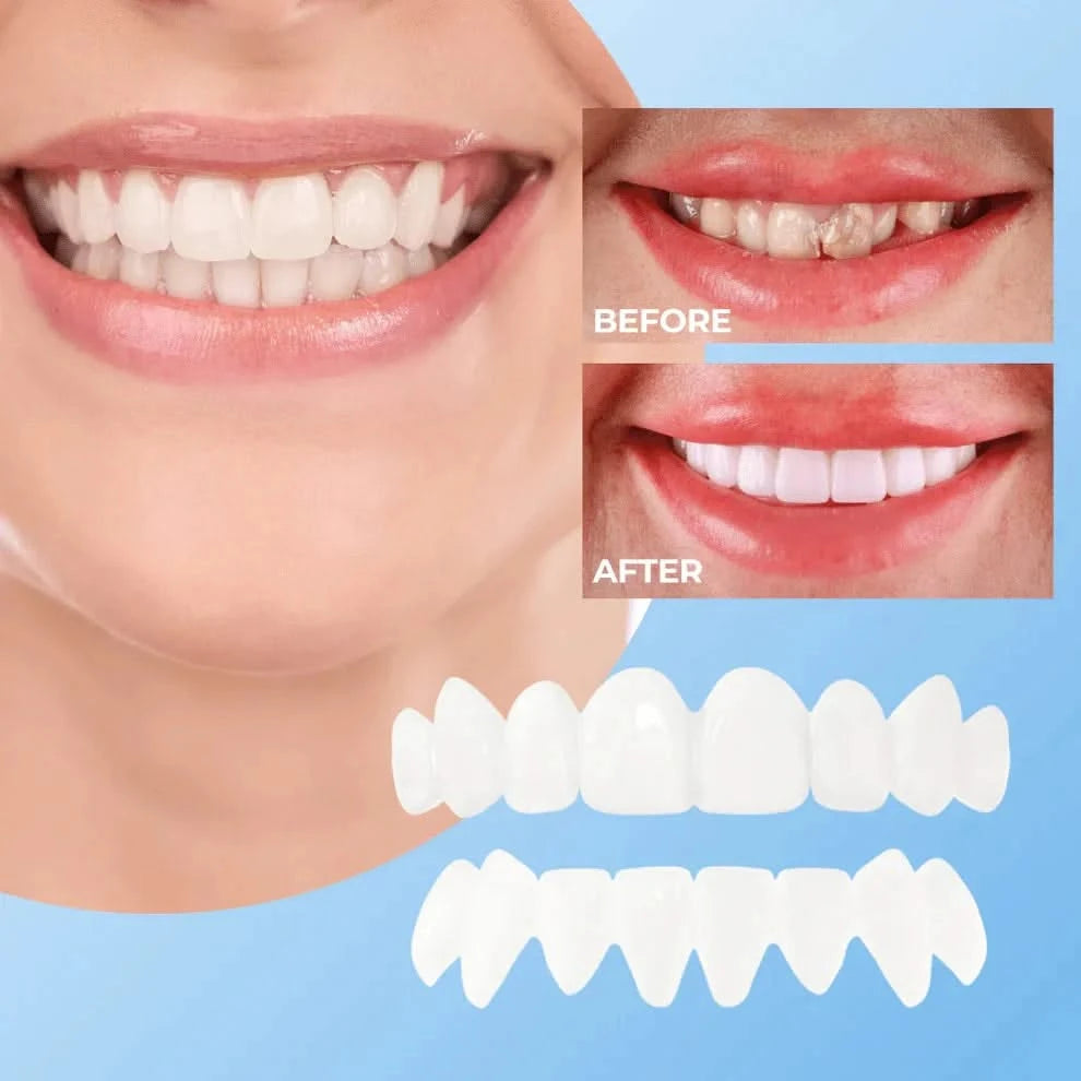 Vavanto Veneers