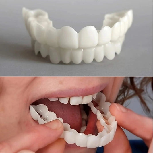 Vavanto Veneers